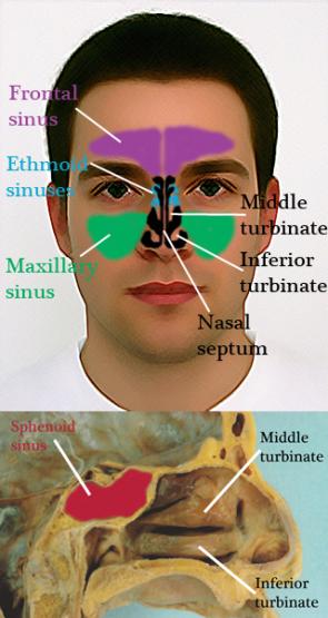 My Sinus Doctor | Patient Education (FAQ) | Resources